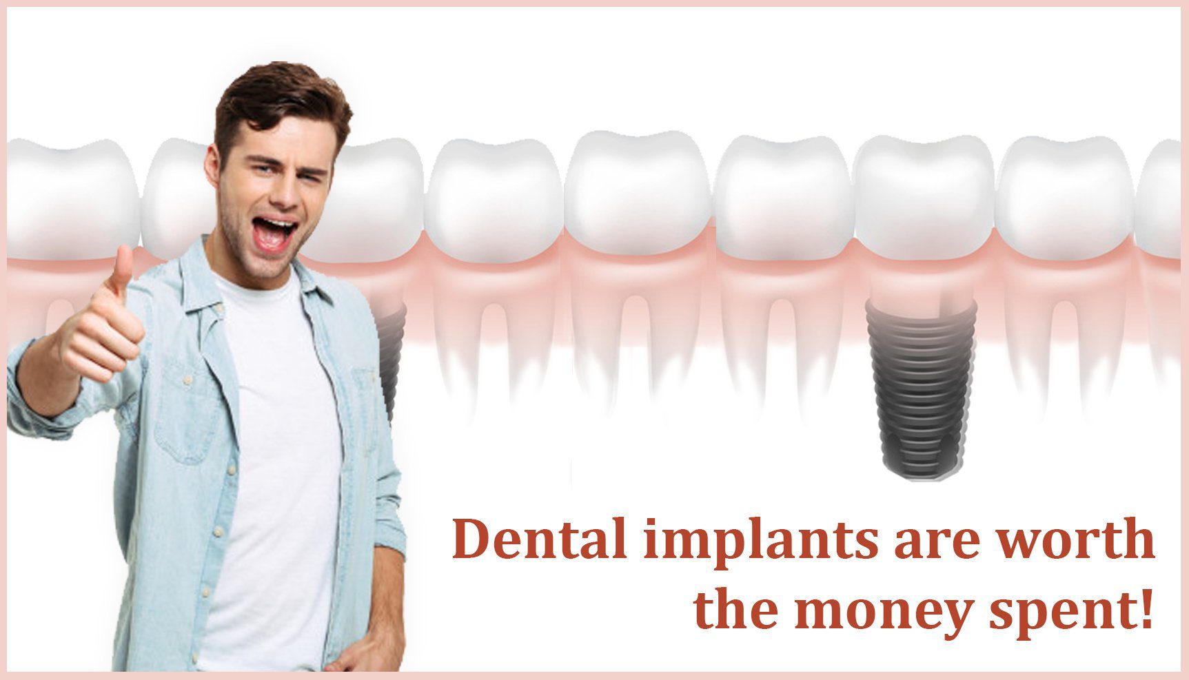 You are currently viewing Dental Implants are Worth the Money Spent