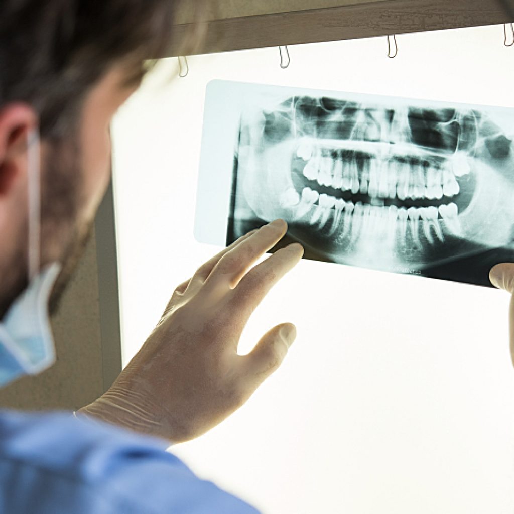 Closeup of dentist looking at dental x-ray plate
