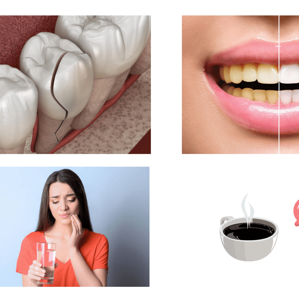 Cracked Teeth, Discoloured Teeth, Heightened sensitivity to taste