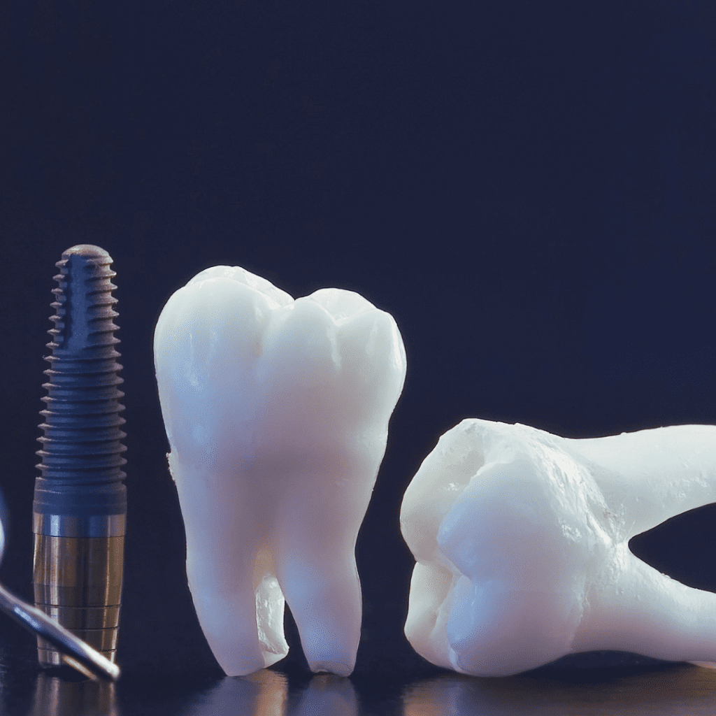 Dental Implants Cost Australia