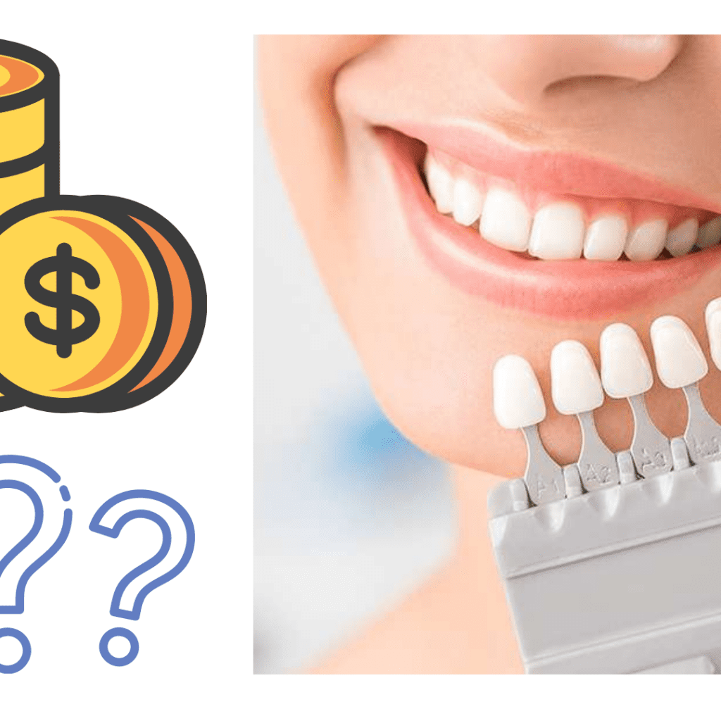 Dental Veneers How much do they cost