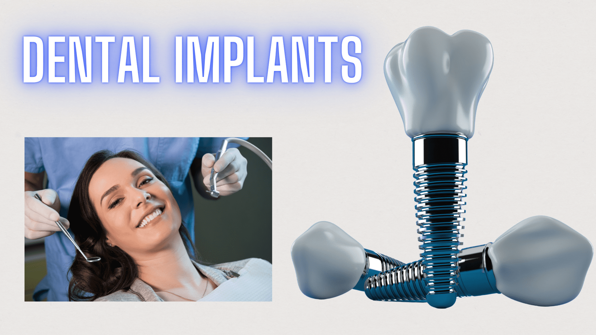 You are currently viewing Let’s Learn About The Nitty-Gritty Of Dental Implants!