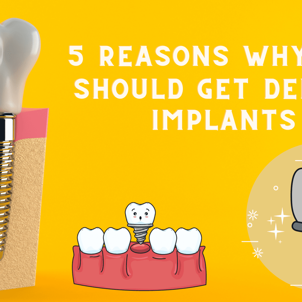 5 Reasons Why You Should Get Dental Implants