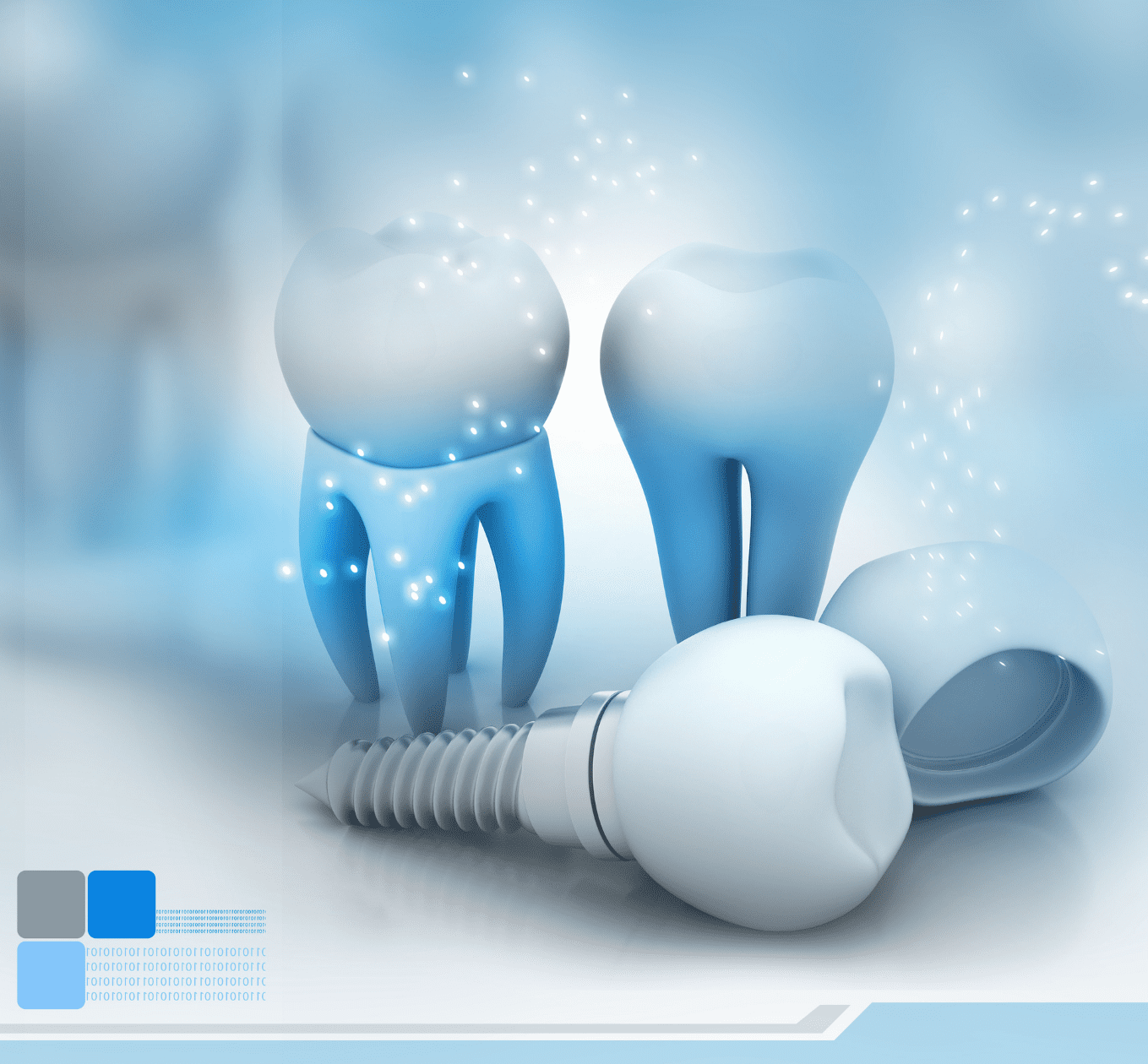 dental implants