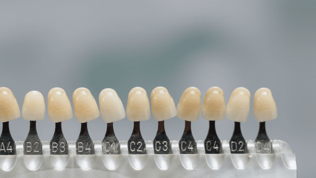 The benefits of dental veneers over other cosmetic treatments